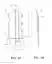 Fig. 04 - Sternum fixation device and method