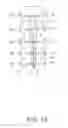 Fig. 09 - Sternum fixation device and method