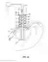 Fig. 09 - Vapor ablation system with a catheter having more than one positioning element and configured to treat duodenal tissue
