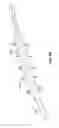 Fig. 101 - Vapor ablation system with a catheter having more than one positioning element and configured to treat duodenal tissue