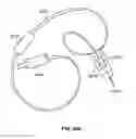 Fig. 103 - Vapor ablation system with a catheter having more than one positioning element and configured to treat duodenal tissue