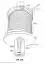 Fig. 124 - Vapor ablation system with a catheter having more than one positioning element and configured to treat duodenal tissue