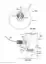 Fig. 125 - Vapor ablation system with a catheter having more than one positioning element and configured to treat duodenal tissue