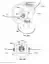 Fig. 126 - Vapor ablation system with a catheter having more than one positioning element and configured to treat duodenal tissue