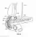 Fig. 16 - Vapor ablation system with a catheter having more than one positioning element and configured to treat duodenal tissue