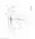 Fig. 20 - Vapor ablation system with a catheter having more than one positioning element and configured to treat duodenal tissue