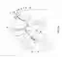 Fig. 29 - Vapor ablation system with a catheter having more than one positioning element and configured to treat duodenal tissue
