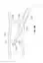 Fig. 40 - Vapor ablation system with a catheter having more than one positioning element and configured to treat duodenal tissue
