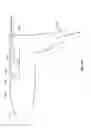 Fig. 47 - Vapor ablation system with a catheter having more than one positioning element and configured to treat duodenal tissue