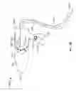 Fig. 51 - Vapor ablation system with a catheter having more than one positioning element and configured to treat duodenal tissue