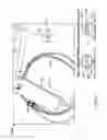 Fig. 53 - Vapor ablation system with a catheter having more than one positioning element and configured to treat duodenal tissue