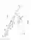 Fig. 72 - Vapor ablation system with a catheter having more than one positioning element and configured to treat duodenal tissue