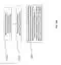 Fig. 78 - Vapor ablation system with a catheter having more than one positioning element and configured to treat duodenal tissue