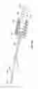 Fig. 79 - Vapor ablation system with a catheter having more than one positioning element and configured to treat duodenal tissue