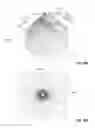 Fig. 94 - Vapor ablation system with a catheter having more than one positioning element and configured to treat duodenal tissue