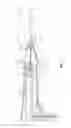 Fig. 03 - Microwave ablation instrument with interchangeable antenna probe
