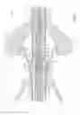 Fig. 06 - Microwave ablation instrument with interchangeable antenna probe