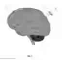 Fig. 02 - PORT TRACKING TOOL