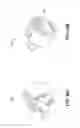 Fig. 16 - Surgical instrument