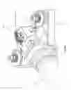 Fig. 07 - Patient-side mechanized surgical system