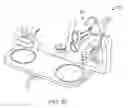 Fig. 35 - Patient-side mechanized surgical system