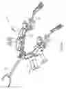 Fig. 36 - Patient-side mechanized surgical system