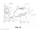 Fig. 02 - Tissue expanders, implants, and methods of use