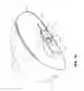 Fig. 04 - Tissue expanders, implants, and methods of use