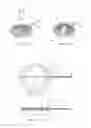 Fig. 32 - Sterile site apparatus, system, and method of using the same