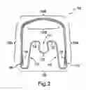 Fig. 03 - Apparatus for applying corrective forces to shape palate