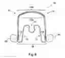 Fig. 07 - Apparatus for applying corrective forces to shape palate