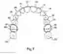 Fig. 08 - Apparatus for applying corrective forces to shape palate