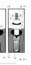 Fig. 01 - DENTAL PROSTHESES DEVICES AND METHODS