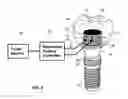 Fig. 05 - DENTAL PROSTHESES DEVICES AND METHODS