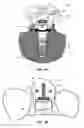 Fig. 10 - DENTAL PROSTHESES DEVICES AND METHODS