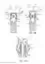 Fig. 19 - DENTAL PROSTHESES DEVICES AND METHODS