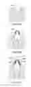 Fig. 43 - DENTAL PROSTHESES DEVICES AND METHODS