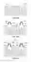 Fig. 44 - DENTAL PROSTHESES DEVICES AND METHODS
