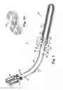 Fig. 03 - Surgical articles and methods
