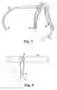 Fig. 08 - Surgical articles and methods
