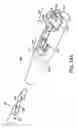 Fig. 16 - Surgical articles and methods