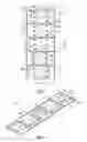 Fig. 02 - Devices and methods for preventing incisional hernias
