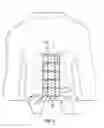 Fig. 03 - Devices and methods for preventing incisional hernias