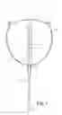 Fig. 02 - Orthotopic artificial bladder endoprosthesis