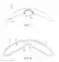 Fig. 07 - Apparatus and methods for nipple and breast formation