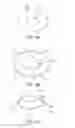 Fig. 08 - Apparatus and methods for nipple and breast formation