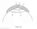 Fig. 10 - Apparatus and methods for nipple and breast formation