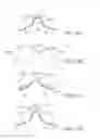 Fig. 13 - Apparatus and methods for nipple and breast formation