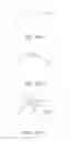 Fig. 14 - Apparatus and methods for nipple and breast formation