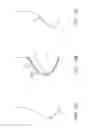 Fig. 16 - Apparatus and methods for nipple and breast formation